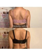 ヴィーナス(Venus)/バストアップで美整骨アプローチ