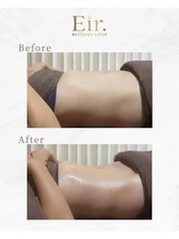 エイル 大橋(Eir.)/before/after