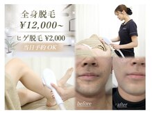 ベアスキン(BARESKIN)