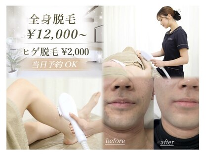 ベアスキン(BARESKIN)の写真