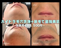 ミーエイト(Mii∞)