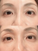 アイモア 吉祥寺店(eye mor.)/まつげパーマ/眉毛/アイブロウ