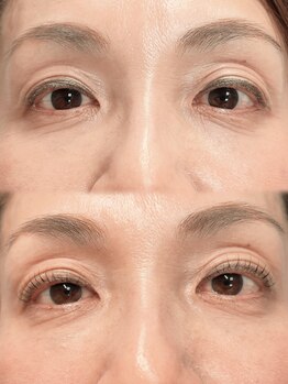 アイモア 吉祥寺店(eye mor.)/まつげパーマ/眉毛/アイブロウ