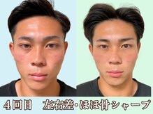 ナチュラルパーフェクトフェイス 新宿/メンズも小顔に/新宿駅小顔矯正