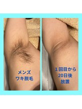 ラ シルク(La silk)/メンズ脇脱毛