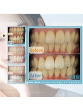 グロウ グロウ(grow.glow)/