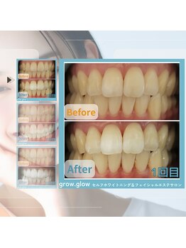 グロウ グロウ(grow.glow)/