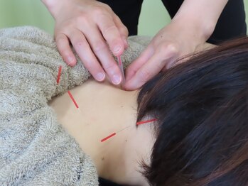 ふくみみ鍼灸接骨院/鍼灸