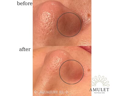 アミュレット(AMULET)の写真