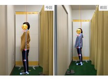 ひろがる接骨院 総社院/～施術経過～