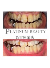 プラチナムビューティー 名古屋栄本店(PLATINUM BEAUTY)/お客様Before After 