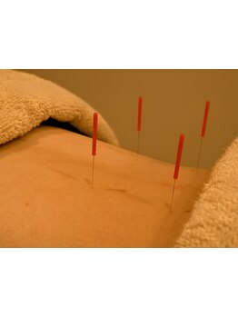 首・肩のつらさを改善したい