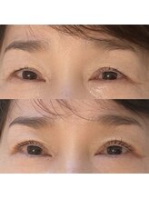 コム(comu)/まつ毛パーマ