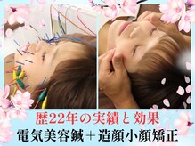 マッチ鍼灸整骨院