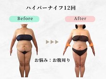 美容整体ウェリナ 中川八田院/.【ダイエットbefore→after】