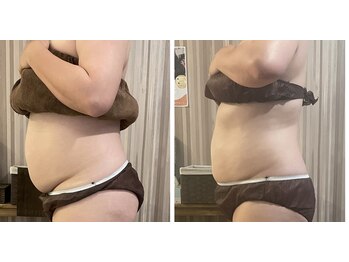 リムアール(Limh R)/