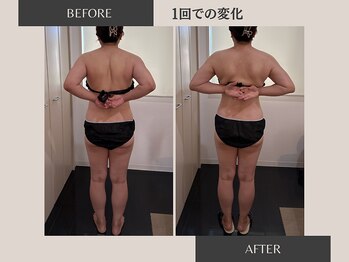 リラ(Rela)/ビフォー、アフター