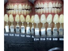 トウキョースワーズ 渋谷店(TOKYO SWRS)/#ホワイトニング #渋谷 #池袋