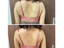 エミニナル(EMININAL)の雰囲気（身体の歪みが整うと共に姿勢改善で背中スッキリのバストケア）