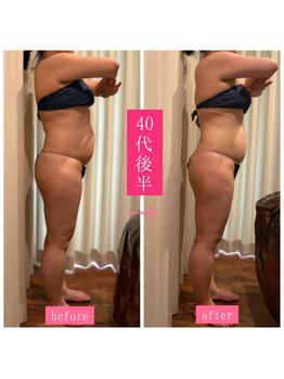 キュール(KuhL)/40代後半痩身ビフォーアフター☆