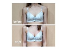 背中やお腹、腕からバストに！筋膜リリースで肩や背中の凝りも◎