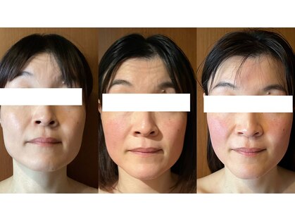 マロカ(Marroka)の写真