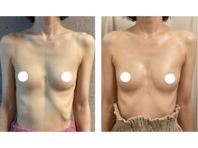 スマイルクルー(SmileClue)/ビフォーアフター症例