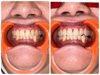 コナホワイトニング 神保町/セルフホワイトニング神保町