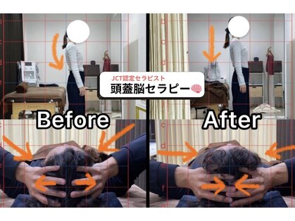 アンフィニ(Infini)の写真