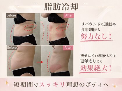 ウィボーテ(We Beaute)の写真