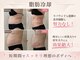 ウィボーテ(We Beaute)の写真