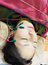 デイジー(DAISY)/美容鍼&小顔矯正