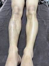 ティグレ 岡山店(TIGRE)/メンズ全身脱毛