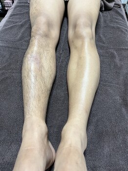 ティグレ 岡山店(TIGRE)/メンズ全身脱毛