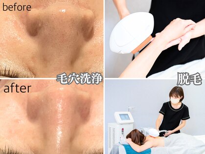 シャラクアクティ(sharaku acty)の写真