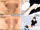 シャラクアクティ(sharaku acty)の写真