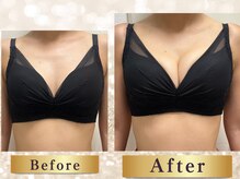 エクラパピヨン 荻窪(Eclatpapillon)/バストアップ＊施術例