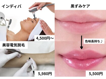 リザルト(Re'ZAlt)の写真