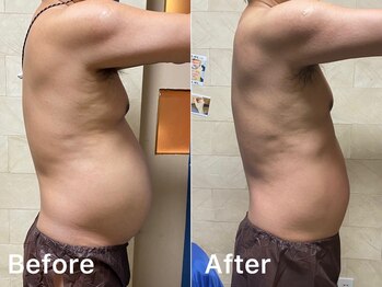 トータルメンズエステ キング(KING)/忙しい男性は癒しダイエット！