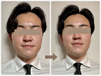 哲心 姫路/同僚から小顔になった？