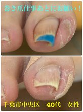 巻き爪じゅん 船橋店/巻き爪20時スタートまで受け付け