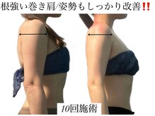 痩身革命 大宮店/黒ずみ改善ハーブピーリング