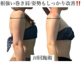 痩身革命 大宮店/黒ずみ改善ハーブピーリング