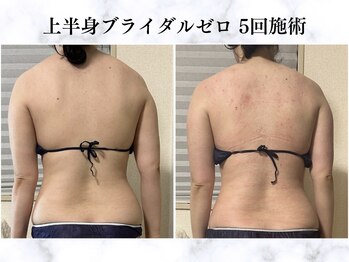 シーフェイス 横浜店(SEE FACE)/ブライダル痩身上半身ダイエット