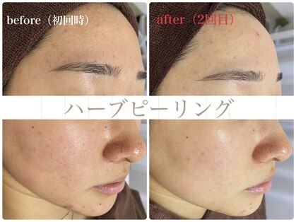 リセットラボ 本店(Reset Lab)の写真