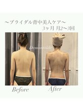 デマントイド(Demantoide&Co)/肩甲骨集中ケア