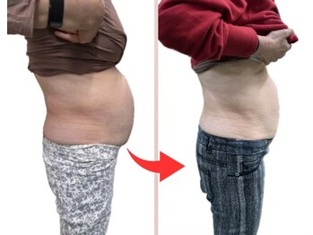 リセル(Recell)/お腹★脂肪分解