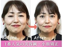 整体院ワト 三軒茶屋店(WATO)の雰囲気（【小顔・美容整体】一度で感動の変化を体験して下さい！）