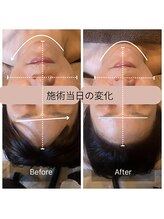 ルーツ(Roots)/エステ