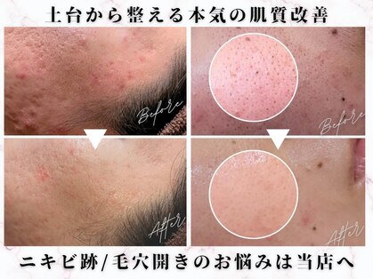 オレンジ(Orange)の写真